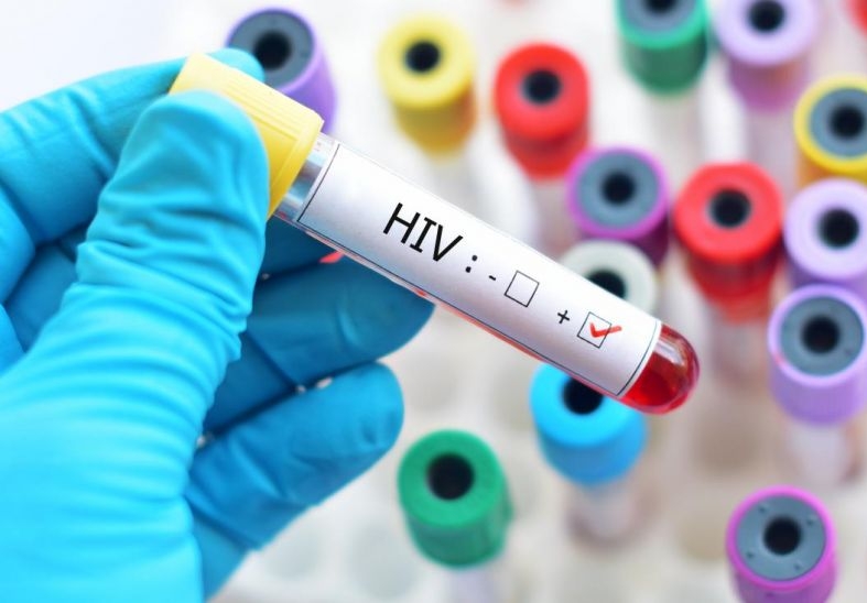 В мире инфицированных ВИЧ всё меньше, а Россия — лидер роста заболеваемости