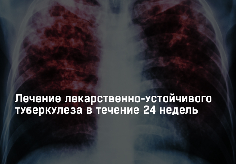 Лечение лекарственно-устойчивого туберкулеза в течение 24 недель